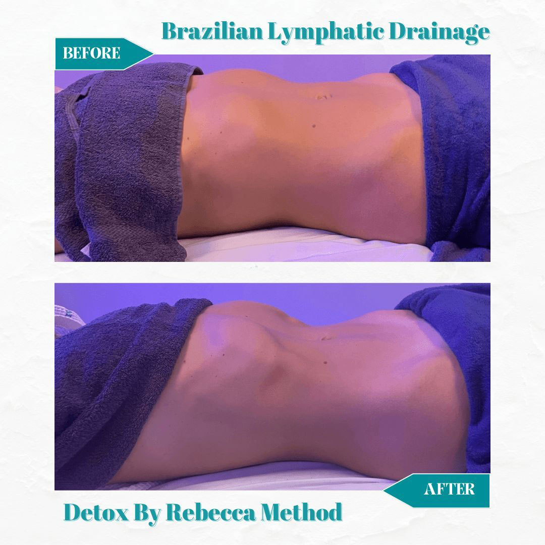 Brazilian Lymphatic Drainage-Detox by Rebecca Method Before and After