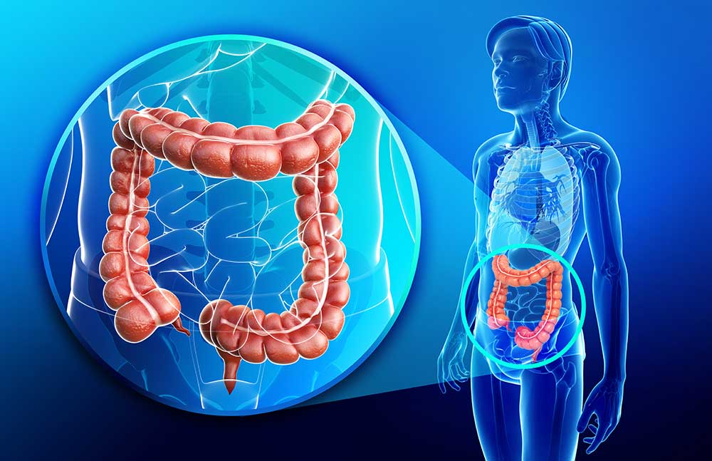 Colonics and Colon Hydrotherapy
