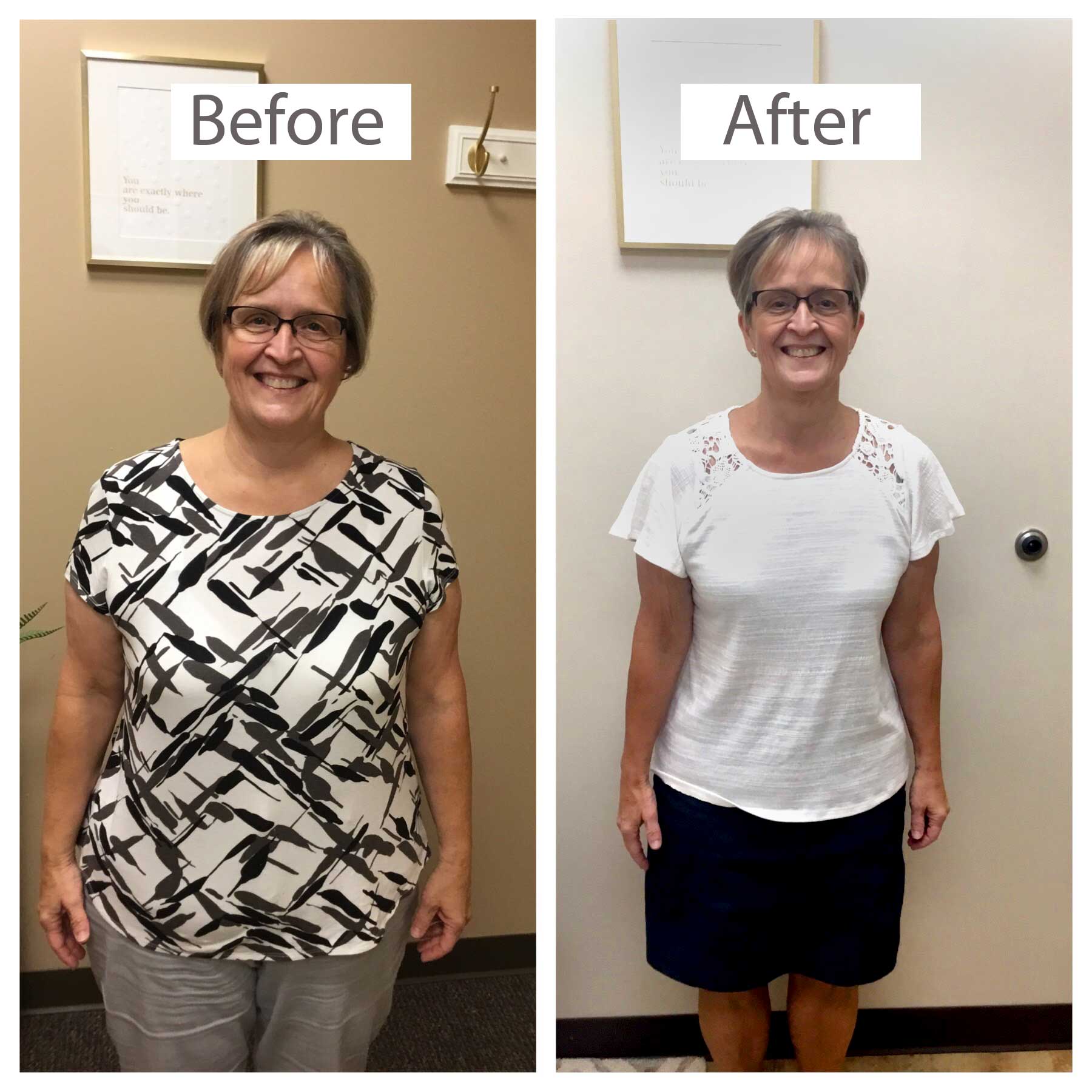 Lori Before and After Keto Diet Weght Loss | VIVA Wellness Milwaukee Weight Loss Clinic