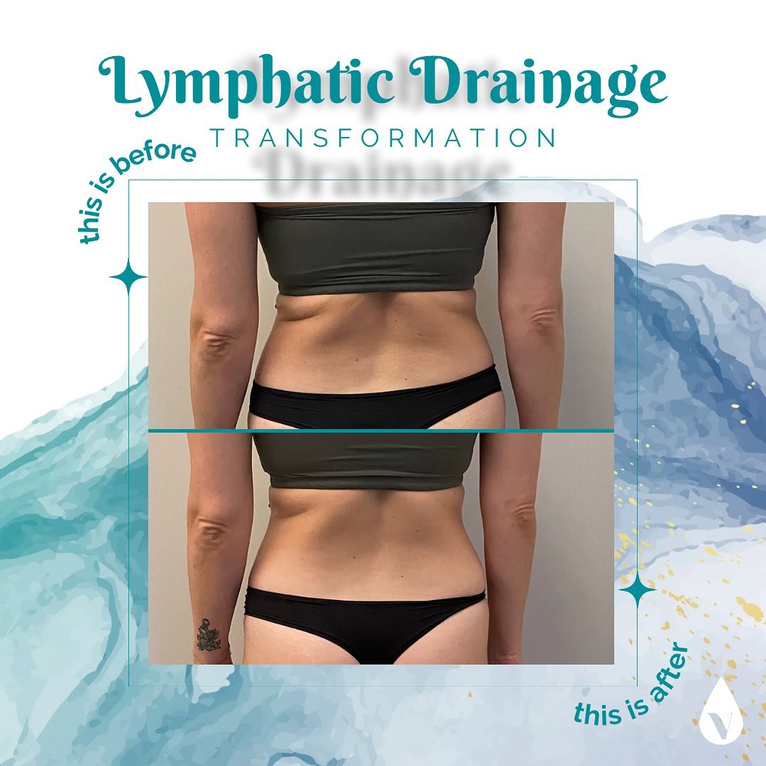 Lymphatic Drainage Client QA