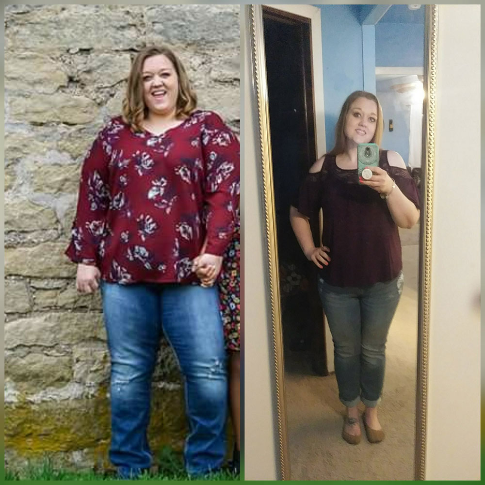 Medical Weight Loss Before and After VIVA Wellness Milwaukee WI