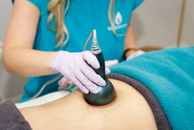 Body Contouring with Cavitation