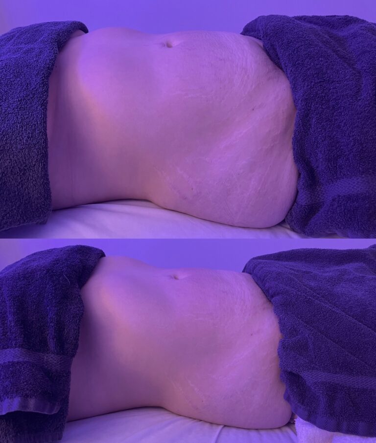 Brazilian Lymphatic Drainage Massage Near Me Brazilian Lymphatic Drainage Massage | Detox By Rebecca™